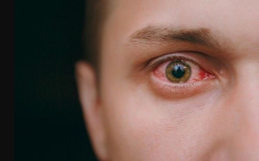 ما المرض الذي يؤثر على العين