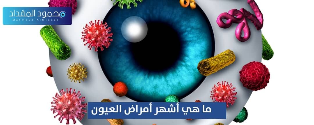 ما هي أشهر أمراض العيون