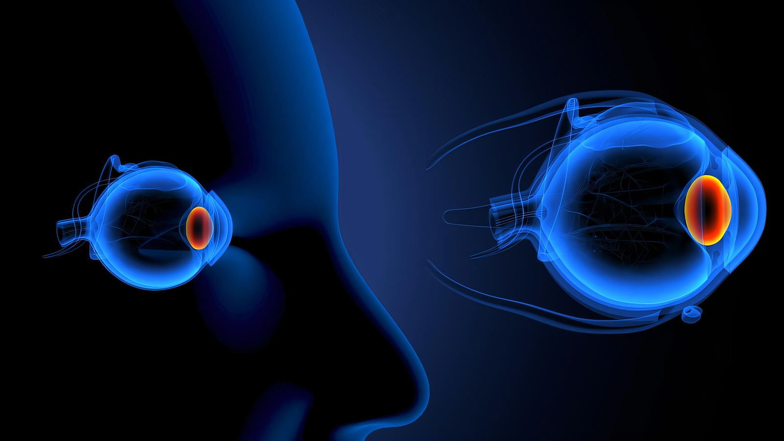 التهاب العصب البصري الأعراض، الأسباب وطرق العلاج