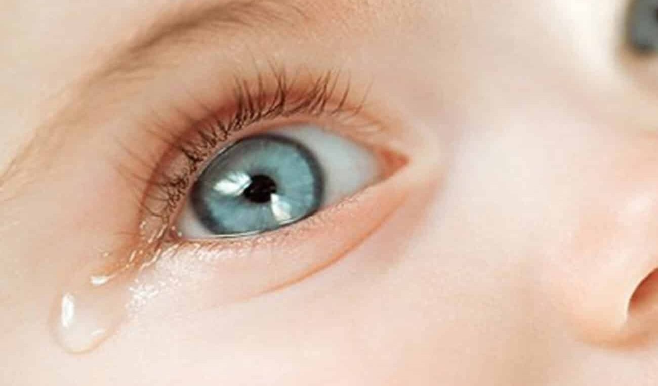 فتح مجرى الدمع للأطفال: الأسباب، الإجراءات، والنصائح بعد العملية