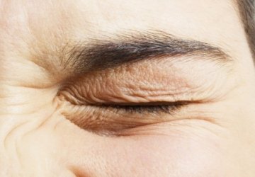 رفرفة العين: الأسباب، الأعراض، وطرق العلاج