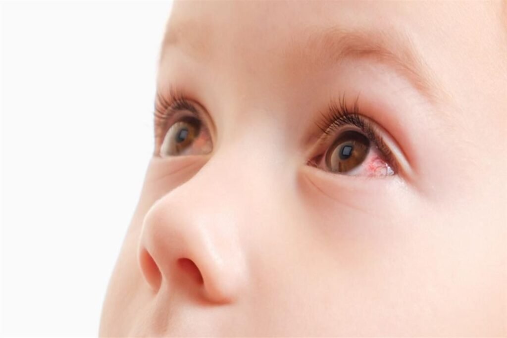 أمراض العيون عند الأطفال