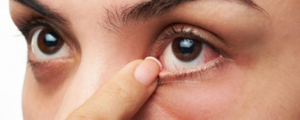 5 طرق طبيعية لتقليل جفاف العين في المنزل