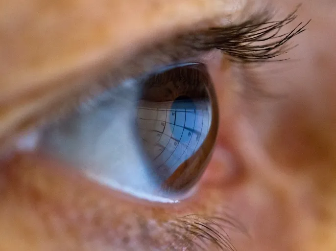 مراجعة طبيب العيون