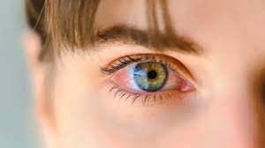 تأثير أمراض الغدة الدرقية على صحة العين