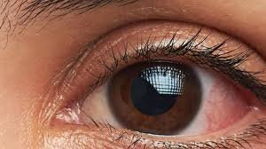 الميكروبيوم العيني: البكتيريا الصديقة التي تحمي العين