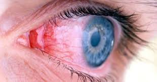 العين مرآة لأمراض الدماغ: كيف تكشف العيون أسرار صحة الجهاز العصبي