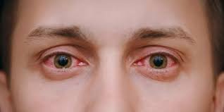 متلازمة كوغان: مرض نادر يصيب العين والأذن معًا