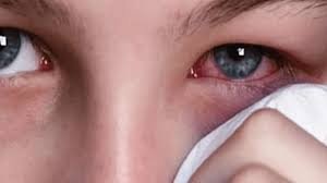 الحساسية البيئية كيف يؤثر التلوث البيئي والغبار والمواد الكيميائية على العين