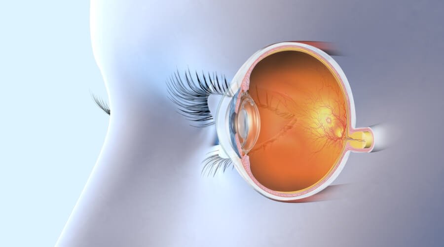 8 أعراض مبكرة لانفصال الجسم الزجاجي يجب الانتباه لها