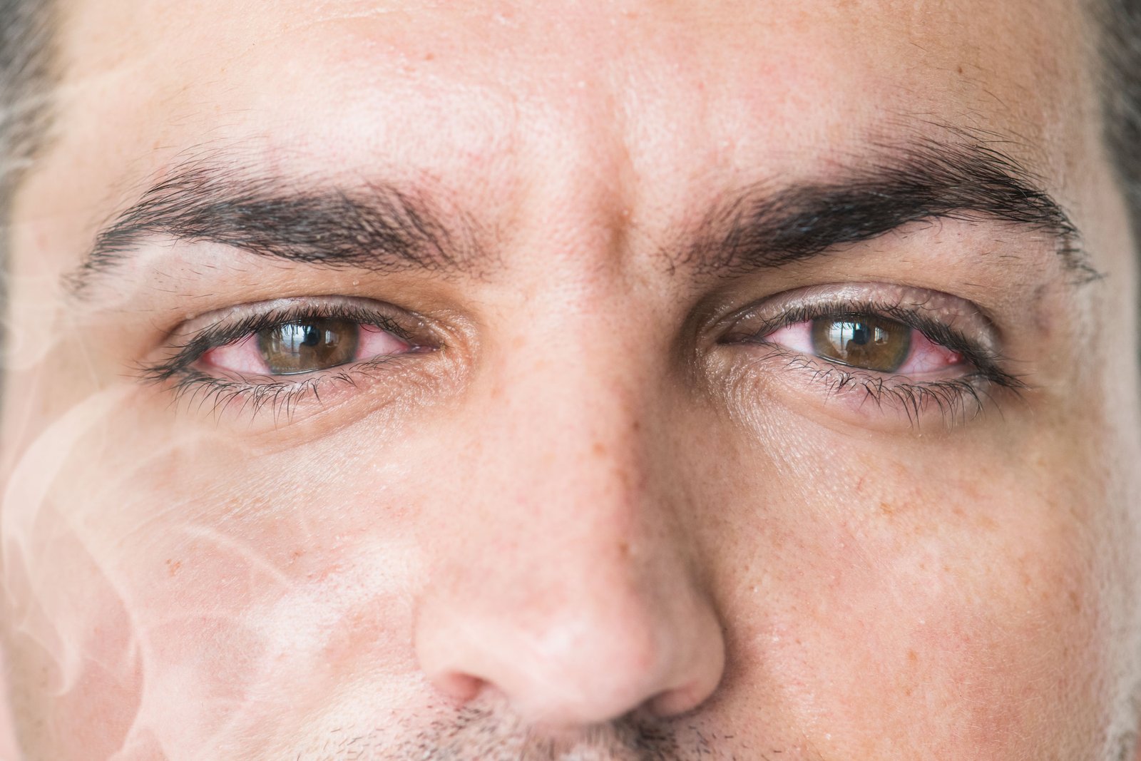 كيف يؤثر التدخين على شبكية العين؟ مخاطر خفية تهدد بصرك